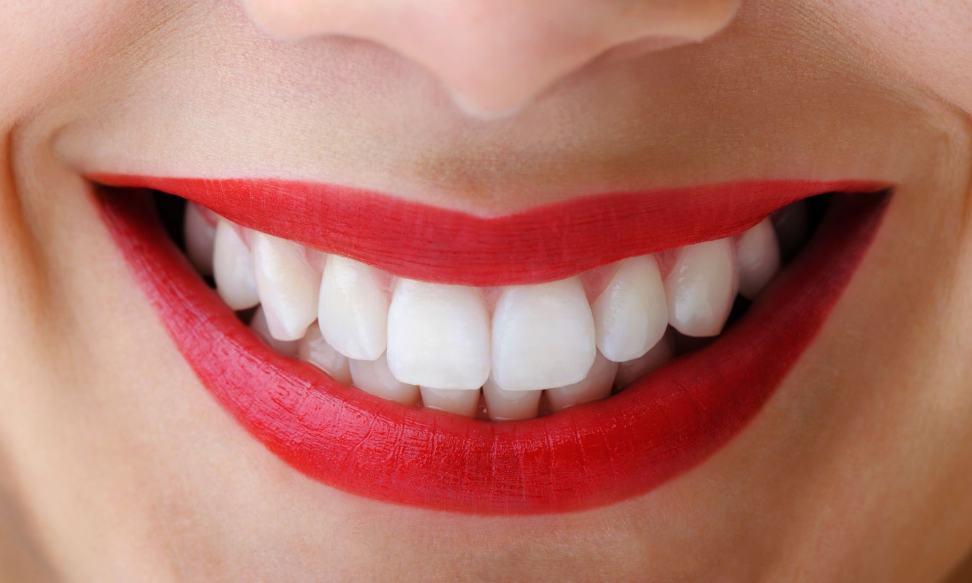 Dişçiye uğramadan dişlerinizi beyazlatın! İşte evde diş byazlatma yöntemleri