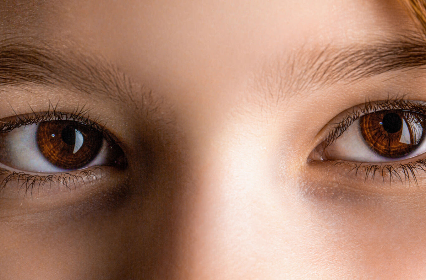 Gözler neden şaşı olur, şaşılık için gerekli tedaviler nelerdir